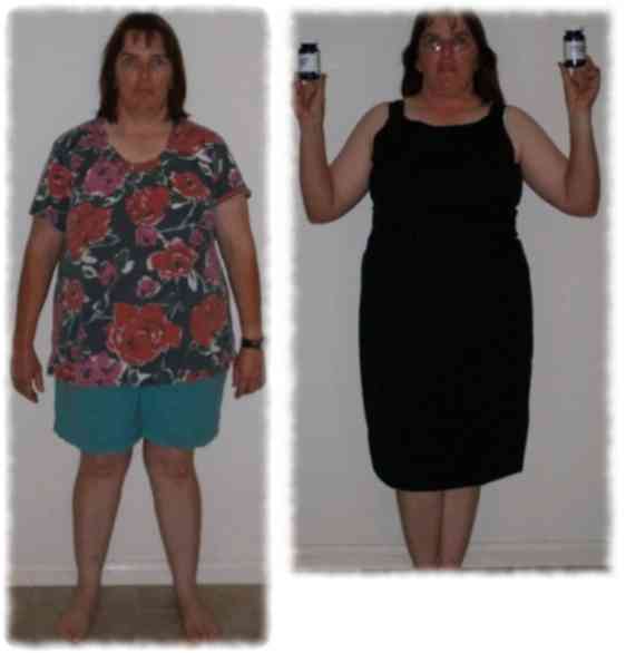 Woman losing weight